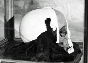 VERSAY ANTLAŞMASINDA NEDEN TANZANYALİ BİR ŞEFİN KAFATASINDAN BAHSEDİLİYOR?